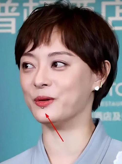 2025新澳门天天开奖记录下载和孙俪唇下痣没了与孙俪嘴唇的痣