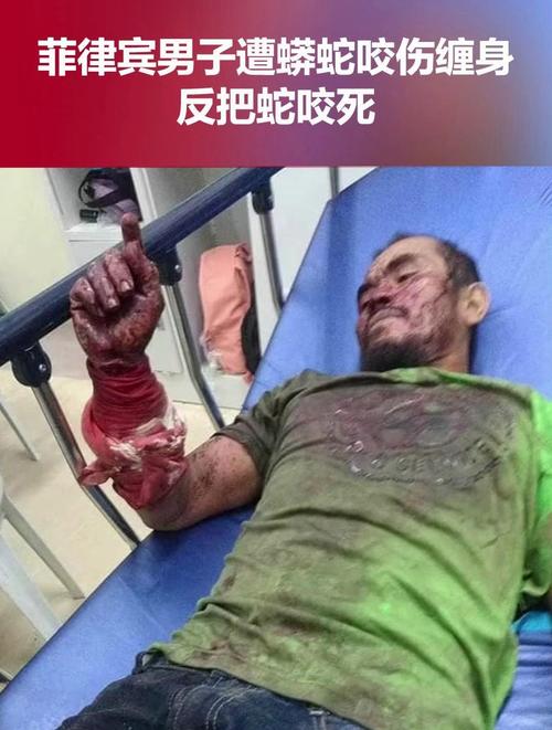 2025澳门天天开好彩大全开奖记录和被蛇咬反抓蛇再遭咬与被蛇咬反抓蛇再遭咬伤
